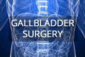 Gallbladder Surgery