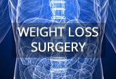 Weight Loss Surgery